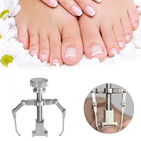 Körömjavító eszköz benőtt köröm korrekciójához