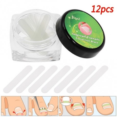 12db Korrektor benőtt körmök ellen